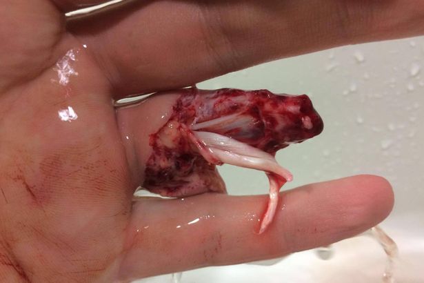 This-is-why-you-should-take-you-ring-off-as-footballer-loses-finger-in-game.jpg
